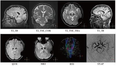 Deep Brain Stimulation Initiative: Toward Innovative Technology, New Disease Indications, and Approaches to Current and Future Clinical Challenges in Neuromodulation Therapy